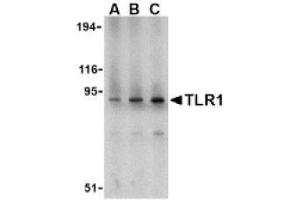 Image no. 1 for anti-Toll-Like Receptor 1 (TLR1) (N-Term) antibody (ABIN951276) (TLR1 anticorps  (N-Term))