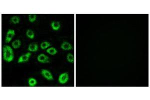 Immunofluorescence (IF) image for anti-ATP synthase subunit delta, mitochondrial (ATP5F1D) (Internal Region) antibody (ABIN1850818) (ATP5F1D anticorps  (Internal Region))