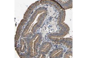 Immunohistochemical staining of human gallbladder with DDX26B polyclonal antibody  shows cytoplasmic positivity, with a granular pattern, in glandular cells at 1:50-1:200 dilution. (DDX26B anticorps)