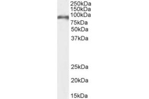 Western Blot using anti-CD155 antibody 3F1. (Recombinant Poliovirus Receptor anticorps)