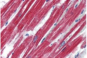 Human Heart (formalin-fixed, paraffin-embedded) stained with LEPR antibody ABIN364407 at 4 ug/ml followed by biotinylated anti-goat IgG secondary antibody ABIN481715, alkaline phosphatase-streptavidin and chromogen. (Leptin Receptor anticorps  (AA 829-841))
