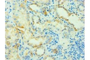 Immunohistochemistry of paraffin-embedded human kidney tissue using ABIN7144142 at dilution of 1:100 (SLC4A2 anticorps  (AA 95-245))
