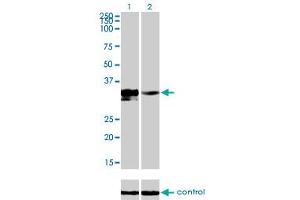 Western blot analysis of DLX3 over-expressed 293 cell line, cotransfected with DLX3 Validated Chimera RNAi (Lane 2) or non-transfected control (Lane 1).