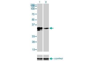 Western blot analysis of DLX3 over-expressed 293 cell line, cotransfected with DLX3 Validated Chimera RNAi (Lane 2) or non-transfected control (Lane 1). (DLX3 anticorps  (AA 1-287))