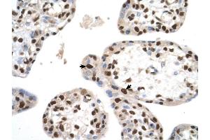 SETD2 antibody was used for immunohistochemistry at a concentration of 4-8 ug/ml to stain Trophoblast cells (arrows) in Human Placenta.