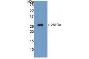 Detection of Recombinant TNFSF14, Human using Polyclonal Antibody to Tumor Necrosis Factor Ligand Superfamily, Member 14 (TNFSF14) (TNFSF14 anticorps  (AA 62-240))