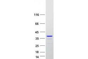 Validation with Western Blot