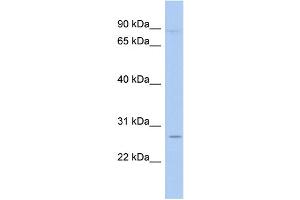 WB Suggested Anti-TLE4 Antibody Titration:  0. (TLE4 anticorps  (N-Term))