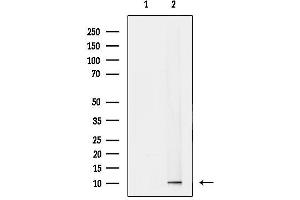 anti-Translocase of Inner Mitochondrial Membrane 9 (TIMM9) (C-Term) antibody