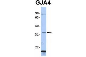 Host:  Rabbit  Target Name:  GJA4  Sample Type:  Hela  Antibody Dilution:  1.