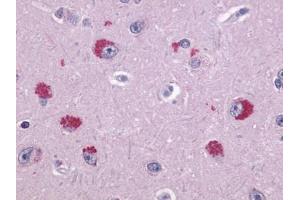 Anti-TAAR1 antibody IHC of human brain, neurons. (TAAR1 anticorps  (Extracellular Domain))