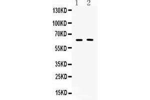 Western blot analysis of TUB 1 expression in COLO320 whole cell lysates ( Lane 1) and MCF-7 whole cell lysates ( Lane 2). (TUB anticorps  (C-Term))