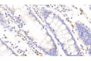 Detection of TJP2 in Human Colon Tissue using Polyclonal Antibody to Tight Junction Protein 2 (TJP2) (TJP2 anticorps  (AA 307-669))