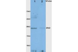 L1 rat liver lysates L2 mouse intestine lysates probed with Anti Adiponectin Polyclonal Antibody, Unconjugated (ABIN669051) at 1:200 overnight at 4 °C. (ADIPOQ anticorps  (AA 151-244))