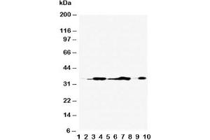 Western blot testing of Annexin V antibody and Lane 1:  rat brain;  2: rat skeletal muscle;  3: rat ovary;  4: rat lung;  5: MCF-7;  6: SMMC-7721;  7: A549;  8: Jurkat;  9: SGC;  10: HT1080;  Predicted molecular weight ~36 kDa. (Annexin V anticorps  (AA 88-102))