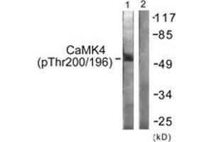Western blot analysis of extracts from K562 cells treated with H2O2 100uM 30', using CaMK4 (Phospho-Thr196/200) Antibody.