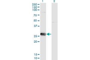 Western Blot analysis of SIRT3 expression in transfected 293T cell line by SIRT3 monoclonal antibody (M09), clone 1A4. (SIRT3 anticorps  (AA 297-399))