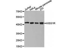 Western Blotting (WB) image for anti-KISS1 Receptor (KISS1R) antibody (ABIN1873420) (KISS1R anticorps)