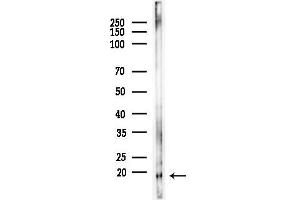 anti-Mitochondrial Ribosomal Protein L36 (MRPL36) (Internal Region) antibody