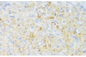 Immunohistochemistry of paraffin-embedded Rat ovary using CACNB3 Polyclonal Antibody at dilution of 1:150 (40x lens). (CACNB3 anticorps)