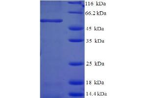 SDS-PAGE (SDS) image for Annexin A2 (ANXA2) (AA 2-339) protein (His-SUMO Tag) (ABIN5709043)