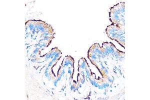 Immunohistochemistry of paraffin-embedded Rat lung using PDXP Rabbit pAb (ABIN7269758) at dilution of 1:100 (40x lens).