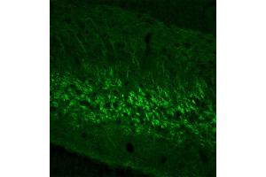 Indirect immunohystochemistry of a rat gyrus dentatus section (dilution 1 : 200). (NEFL anticorps  (AA 1-284))