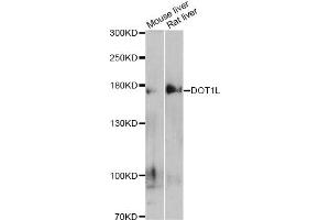 Western blot analysis of extracts of various cell lines, using DOT1L antibody (ABIN5997614) at 1/500 dilution. (DOT1L anticorps)