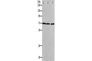 Western Blotting (WB) image for anti-Protein Arginine Methyltransferase 5 (PRMT5) antibody (ABIN2426359) (PRMT5 anticorps)