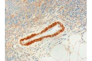 ABIN2560694 (3µg/ml) staining of paraffin embedded Human Lymph Node. (USP20 anticorps  (C-Term))