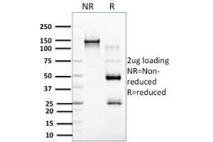 SDS-PAGE Analysis Purified RCAS1 Mouse Monoclonal Antibody (CPTC-EBAG9-2). (RCAS1 anticorps)