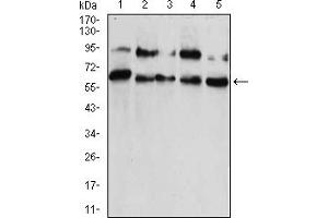 Western Blotting (WB) image for anti-Chromobox Homolog 2 (CBX2) (AA 402-525) antibody (ABIN5883833) (CBX2 anticorps  (AA 402-525))