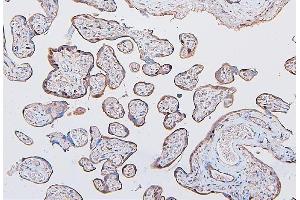 IHC analysis of COMT using anti-COMT antibody (ABIN7601948).