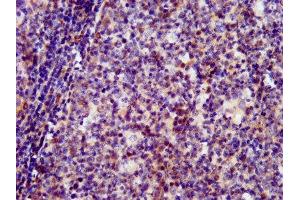 IHC image of ABIN7162487 diluted at 1:400 and staining in paraffin-embedded human tonsil tissue performed on a Leica BondTM system.