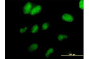 Immunofluorescence of purified MaxPab antibody to TCEAL1 on HeLa cell.