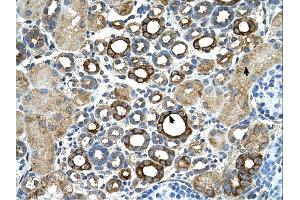 Immunohistochemistry (IHC) image for anti-Suppression of Tumorigenicity 14 (Colon Carcinoma) (ST14) (C-Term) antibody (ABIN2773910) (ST14 anticorps  (C-Term))