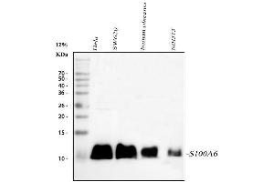 Western blot analysis of S100A6 using anti-S100A6 antibody (ABIN3043320).