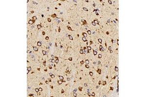 Immunohistochemistry analysis of paraffin embedded mouse brain using Neurotensin (ABIN7074827) at dilution of 1: 400
