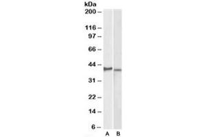 Western blot testing of KELLY [A] and U251-MG [B] lysates with CX3CR1 antibody at 2ug/ml. (CX3CR1 anticorps)