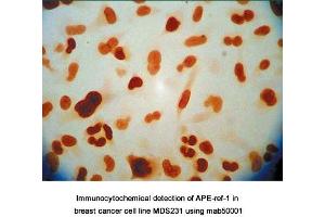 Image no. 7 for anti-DNA Repair Protein Apurinic Endonuclease antibody (ABIN5693483) (DNA Repair Protein Apurinic Endonuclease anticorps)
