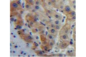 IHC-P analysis of Liver tissue, with DAB staining. (GDF5 anticorps  (AA 382-501))