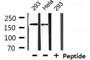 Western blot analysis of extracts from 293 and Hela, using Collagen IV Antibody.