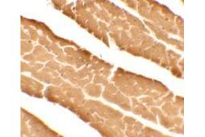 Immunohistochemistry of DDA1 in mouse heart tissue with DDA1 antibody at 5 ug/mL. (DDA (C-Term) anticorps)