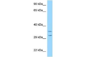 WB Suggested Anti-RPS2 Antibody Titration: 1. (RPS2 anticorps  (Middle Region))