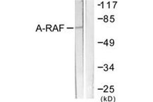 Western blot analysis of extracts from HeLa cells, treated with PMA 125ng/ml 30', using A-RAF (Ab-301/302) Antibody. (ARAF anticorps  (AA 276-325))