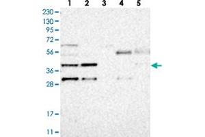 Western blot analysis of Lane 1: RT-4, Lane 2: U-251 MG, Lane 3: Human Plasma, Lane 4: Liver, Lane 5: Tonsil with MB21D1 polyclonal antibody . (C6orf150 anticorps)