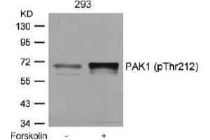 Image no. 1 for anti-P21-Activated Kinase 1 (PAK1) (pThr212) antibody (ABIN196878) (PAK1 anticorps  (pThr212))