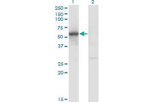 Western Blot analysis of FLI1 expression in transfected 293T cell line by FLI1 monoclonal antibody (M01), clone 1G8.