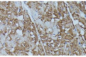 Immunohistochemistry of paraffin-embedded Rat heart using FKBP1B Polyclonal Antibody at dilution of 1:100 (40x lens).