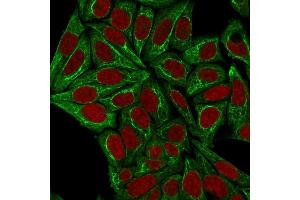 Immunofluorescence staining of HeLa cells using Pan-Cytokeratin Mouse Monoclonal Antibody (PCK/3150) followed by goat anti-Mouse IgG conjugated to CF488 (green). (KRT anticorps)